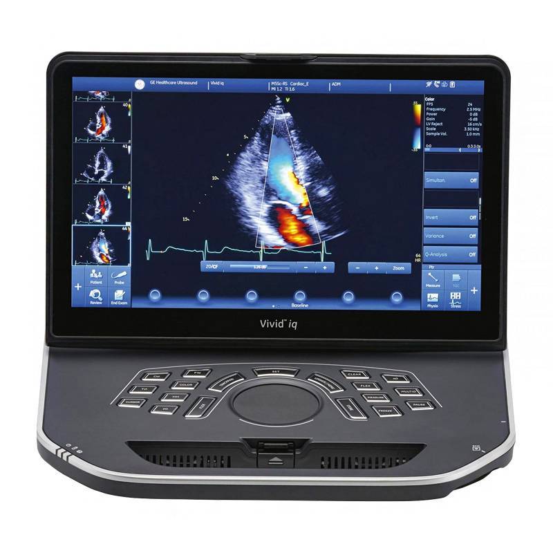 Ультразвуковая система Vivid iq